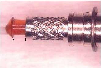outer view of fiber optic termination showing jacket shrinkback
